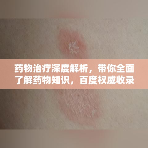 药物治疗深度解析，带你全面了解药物知识，百度权威收录！
