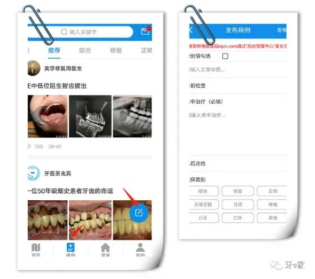 e看牙官方下载及屠神媒体激活码,数据整合设计执行-XE版_v10.303